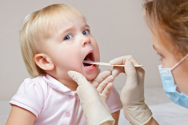 Bí quyết chăm sóc răng miệng cho trẻ em bị sâu răng 